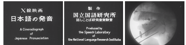 X線